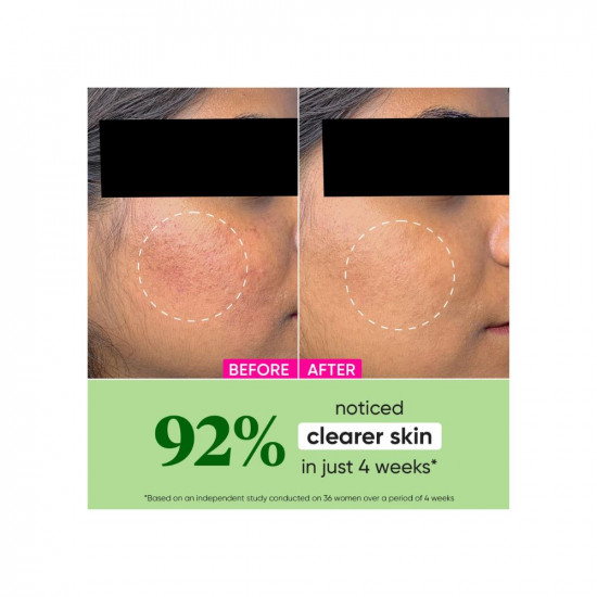 Dot & Key CICA + Niacinamide Spot Reduction Moisturizer for Acne Prone Skin